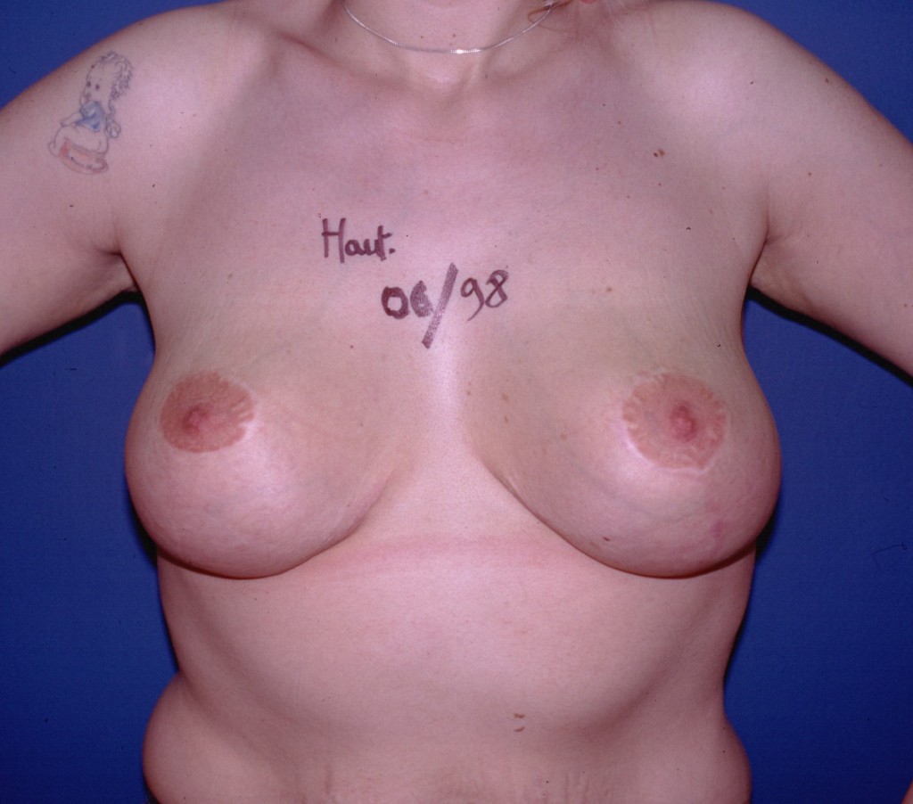 htm-face-post
