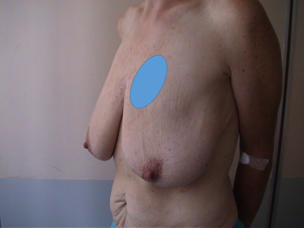pm-post-gastro-profil-pre